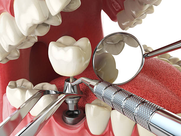 Best 24-Hour Emergency Dental Care in North Muskegon, MI