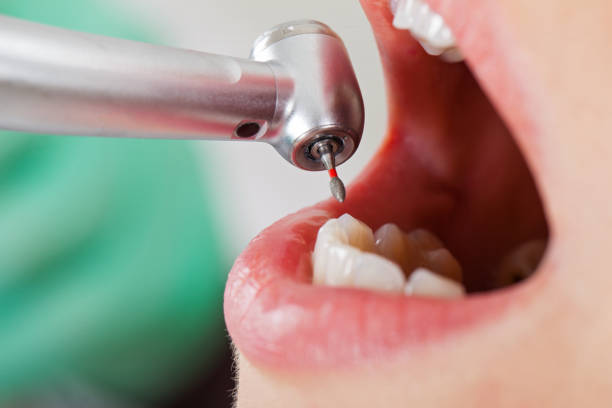 Best Emergency Treatment for Oral Infections in North Muskegon, MI
